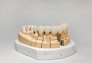 Yetişkinlerde Ortodonti Tedavisi
